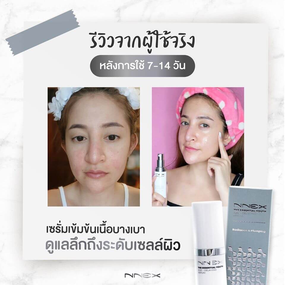 Nnex,Nnex Serum,Nnex Serum ราคา,Nnex Serum pantip,Nnex Serum Jeban,Nnex Serum ใช้ดีไหม